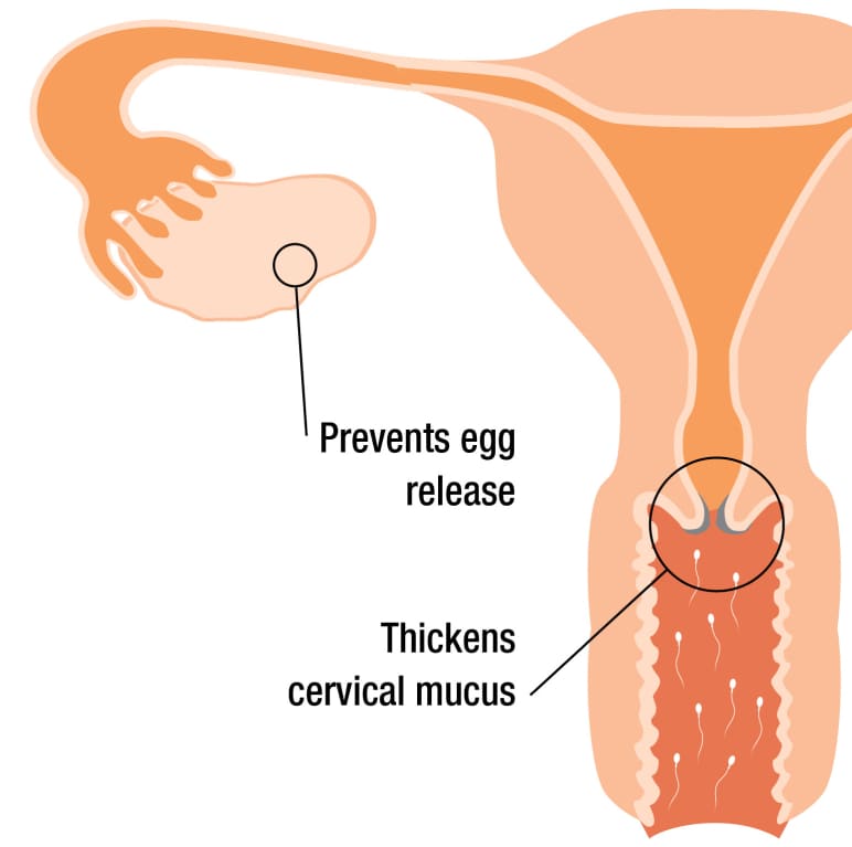 prevent_pregnancy prevent_pregnancy
